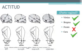 ACTITUD
¿Parto vaginal?
➢ Vértice
➢ Bregma
➢ Frente
➢ Cara
95% 0,1-0,3% 0,04-0,1% 1/500-600
 