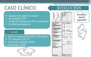 CASO CLÍNICO EVOLUCIÓN
➢ Ingreso por parto en curso
➢ Se canaliza VVP
➢ Protocolo Embarazo No Controlado
➢ Se abre partograma
➢ RCTG: taquicardia fetal. LB:165lpm
➢ Tª materna: 36,7ºC
➢ Se decide intentar RAM
➢ Prosición: NIIP
11:00h
Decúbito
lateral
izquierdo
 
