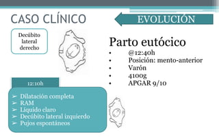 CASO CLÍNICO EVOLUCIÓN
12:10h
➢ Dilatación completa
➢ RAM
➢ Líquido claro
➢ Decúbito lateral izquierdo
➢ Pujos espontáneos
Parto eutócico
• @12:40h
• Posición: mento-anterior
• Varón
• 4100g
• APGAR 9/10
Decúbito
lateral
derecho
 