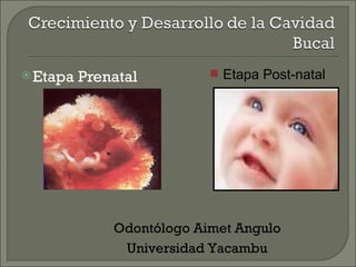  Etapa   Prenatal          Etapa Post-natal




              Odontólogo Aimet Angulo
               Universidad Yacambu
 