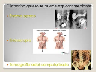 LAS CONTRACCIONES DE LAS VELLOSIDADES “ ORDEÑAN SU CONTENIDO, DE FORMA QUE LA LINFA FLUYE LIBREMENTE DESDE LOS QUILÍFEROS CENTRALES DE LAS VELLOSIDADES HACIA EL SISTEMA LINFÁTICO. FUNCIÓN DE LA VÁLVULA ILEOCECAL.     EVITAR EL REFLUJO DEL CONTENIDO FECAL DEL COLON HACIA EL INTESTINO DELGADO.     LAS VALVAS DE LA VÁLVULA ILEOCECAL SOBRESALEN HACIA LA LUZ DEL CIEGO, POR LO QUE SE CIERRAN CON FUERZA CUANDO EL CONTENIDO DE ESTE TRATA DE ATRAVESARLAS POR UN EXCESO DE PRESIÓN EN SU INTERIOR.     LA  VÁLVULA ILEOCECAL POSEE UNA GRUESA CAPA MUSCULAR CIRCULAR  LLAMADA ESFÍNTER ILEOCECAL.