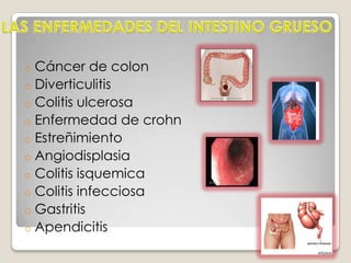 INTESTINO GRUESO