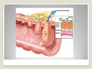 Durante este proceso las células que recubren el colon reabsorben agua del quimo, cambiando su estado de líquido a sólido. Miles de millones de bacterias dentro del colon sintetizan sales que no han sido digeridas en su paso por el intestino delgado y las vitaminas K y B, así como gases hidrógeno, dióxido de carbono, sulfuro de hidrógeno y metano.Segmentos musculares del intestino grueso, llamados haustros, empujan esta materia y la remueven dentro del intestino grueso con movimientos sucesivos, mezclándola por completo.