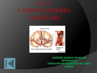 E.C.V( Evento Cerebro Vascular) JENNIFER ANDREA CASALLAS.  INFORMATICA FUNDACION UNIVERSITARIA DEL AREA ANDINA . 1 