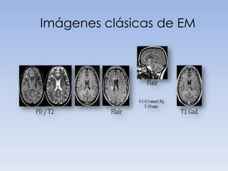 Imágenes clásicas de EM

 