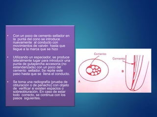 • Con un poco de cemento sellador en
la punta del cono se introduce
nuevamente al conducto con
movimientos de vaivén hasta que
llegue a la marca que se hizo
• Utilizando un espaciador, se produce
lateralmente lugar para introducir una
punta de gutapercha accesoria (no
estandarizada) con un poco del
cemento sellador. Se repite este
paso hasta que se llena el conducto.
• Se toma una radiografía (prueba de
obturación o de penacho) con objeto
de verificar si existen espacios o
sobreobturación. En caso de estar
todo correcto, se continua con los
pasos siguientes.
 