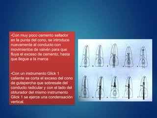 •Con muy poco cemento sellador
en la punta del cono, se introduce
nuevamente al conducto con
movimientos de vaivén para que
fluya el exceso de cemento, hasta
que llegue a la marca
•Con un instrumento Glick 1
caliente se corta el exceso del cono
de gutapercha que sobresale del
conducto radicular y con el lado del
obturador del mismo instrumento
Glick 1 se ejerce una condensación
vertical.
 
