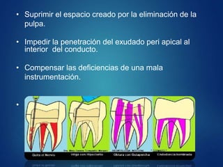 • Suprimir el espacio creado por la eliminación de la
pulpa.
• Impedir la penetración del exudado peri apical al
interior del conducto.
• Compensar las deficiencias de una mala
instrumentación.
• Permitir el cierre biológico
 