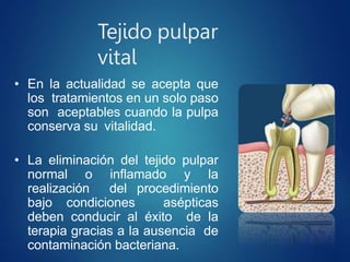 Tejido pulpar
vital
• En la actualidad se acepta que
los tratamientos en un solo paso
son aceptables cuando la pulpa
conserva su vitalidad.
• La eliminación del tejido pulpar
normal o inflamado y la
realización del procedimiento
bajo condiciones asépticas
deben conducir al éxito de la
terapia gracias a la ausencia de
contaminación bacteriana.
 