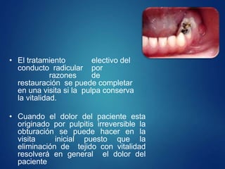 • El tratamiento electivo del
conducto radicular por
razones de
restauración se puede completar
en una visita si la pulpa conserva
la vitalidad.
• Cuando el dolor del paciente esta
originado por pulpitis irreversible la
obturación se puede hacer en la
visita inicial puesto que la
eliminación de tejido con vitalidad
resolverá en general el dolor del
paciente
 