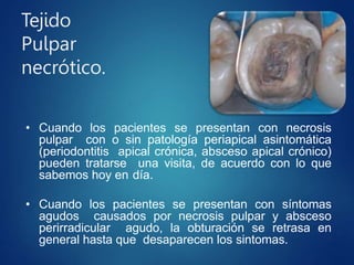 Tejido
Pulpar
necrótico.
• Cuando los pacientes se presentan con necrosis
pulpar con o sin patología periapical asintomática
(periodontitis apical crónica, absceso apical crónico)
pueden tratarse una visita, de acuerdo con lo que
sabemos hoy en día.
• Cuando los pacientes se presentan con síntomas
agudos causados por necrosis pulpar y absceso
perirradicular agudo, la obturación se retrasa en
general hasta que desaparecen los sintomas.
 