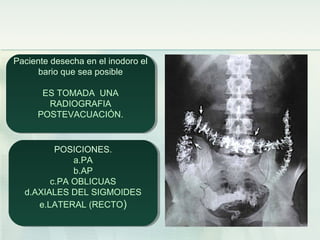 Paciente desecha en el inodoro el
bario que sea posible
ES TOMADA UNA
RADIOGRAFIA
POSTEVACUACIÓN.
Paciente desecha en el inodoro el
bario que sea posible
ES TOMADA UNA
RADIOGRAFIA
POSTEVACUACIÓN.
POSICIONES.
a.PA
b.AP
c.PA OBLICUAS
d.AXIALES DEL SIGMOIDES
e.LATERAL (RECTO)
POSICIONES.
a.PA
b.AP
c.PA OBLICUAS
d.AXIALES DEL SIGMOIDES
e.LATERAL (RECTO)
 