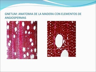 GNETUM: ANATOMIA DE LA MADERA CON ELEMENTOS DE ANGIOSPERMAS 