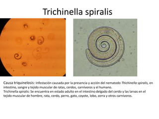 Trichinella spiralis

Causa triquinelosis: Infestación causada por la presencia y acción del nematodo Thichinella spiralis, en
intestino, sangre y tejido muscular de ratas, cerdos, carnívoros y el humano.
Trichinella spiralis: Se encuentra en estado adulto en el intestino delgado del cerdo y las larvas en el
tejido muscular de hombre, rata, cerdo, perro, gato, coyote, lobo, zorra y otros carnívoros.

 