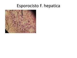 Esporocisto F. hepatica

 