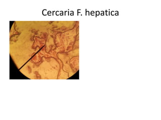 Cercaria F. hepatica

 