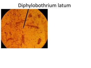 Diphylobothrium latum

 