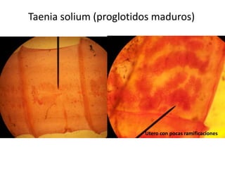 Taenia solium (proglotidos maduros)

Utero con pocas ramificaciones

 