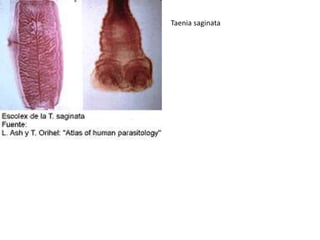 Taenia saginata

 