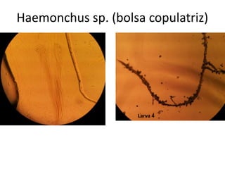 Haemonchus sp. (bolsa copulatriz)

Larva 4

 