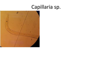 Capillaria sp.

 