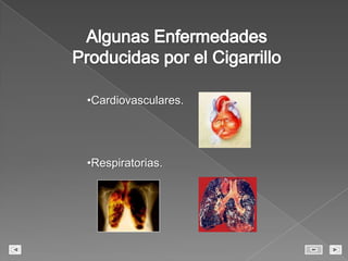 Algunas Enfermedades Producidas por el CigarrilloCardiovasculares.