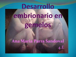 Desarrollo embrionario en gemelos Ana Maria Parra Sandoval 4.E 