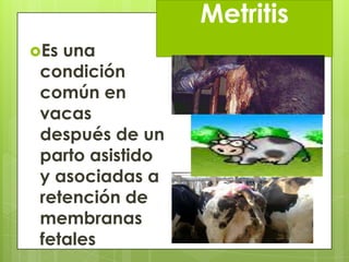 Metritis
Es

una
condición
común en
vacas
después de un
parto asistido
y asociadas a
retención de
membranas
fetales

 