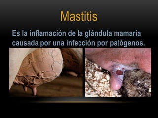 Mastitis
Es la inflamación de la glándula mamaria
causada por una infección por patógenos.

 