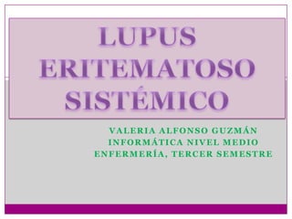 LUPUS ERITEMATOSO SISTÉMICO Valeria Alfonso Guzmán Informática nivel medio Enfermería, tercer semestre 