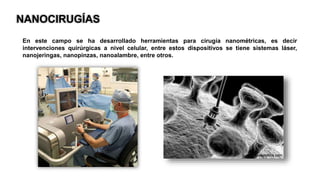 NANOCIRUGÍAS
En este campo se ha desarrollado herramientas para cirugía nanométricas, es decir
intervenciones quirúrgicas a nivel celular, entre estos dispositivos se tiene sistemas láser,
nanojeringas, nanopinzas, nanoalambre, entre otros.
 
