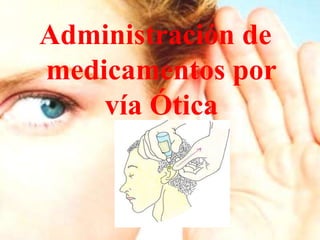 Administración de
medicamentos por
    vía Ótica
 