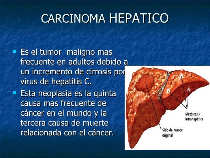 Correr cremas para quemar grasa abdominal eficaces suelo con cremas para quemar grasa abdominal eficaces