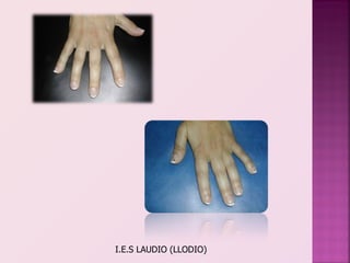 I.E.S LAUDIO (LLODIO)
 