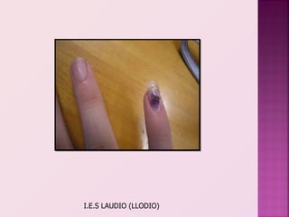 I.E.S LAUDIO (LLODIO)
 