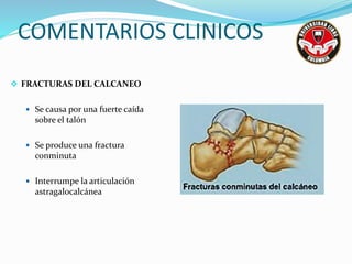 COMENTARIOS CLINICOS
 FRACTURAS DEL CALCANEO
 Se causa por una fuerte caída
sobre el talón
 Se produce una fractura
conminuta
 Interrumpe la articulación
astragalocalcánea
 