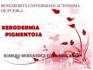 BENEMERITA UNIVERSIDAD AUTONOMA
DE PUEBLA



XERODERMIA
 PIGMENTOSA


 Romero Hernández Edna Giovanna

                 XERODERMIA PIGMENTOSA   1
 