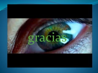 gracias
 