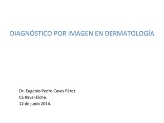 DIAGNÓSTICO POR IMAGEN EN DERMATOLOGÍA
Dr. Eugenio Pedro Cases Pérez.
CS Raval-Elche.
12 de junio 2014.
 
