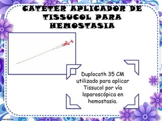CATÉTER APLICADOR DE
   TISSUCOL PARA
    HEMOSTASIA
 