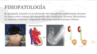 FISIOPATOLOGÍA
Su patogenia consiste en la afectación del mesodermo embrionario durante
la cuarta-sexta semana del desarrollo que condiciona diversas alteraciones
en órganos y sistemas, originando diferentes manifestaciones clínicas