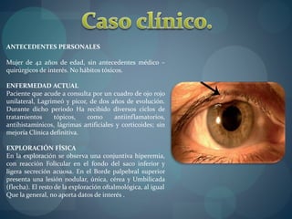 ANTECEDENTES PERSONALES 
Mujer de 42 años de edad, sin antecedentes médico – 
quirúrgicos de interés. No hábitos tóxicos. 
ENFERMEDAD ACTUAL 
Paciente que acude a consulta por un cuadro de ojo rojo 
unilateral, Lagrimeó y picor, de dos años de evolución. 
Durante dicho periodo Ha recibido diversos ciclos de 
tratamientos tópicos, como antiinflamatorios, 
antihistamínicos, lágrimas artificiales y corticoides; sin 
mejoría Clínica definitiva. 
EXPLORACIÓN FÍSICA 
En la exploración se observa una conjuntiva hiperemia, 
con reacción Folicular en el fondo del saco inferior y 
ligera secreción acuosa. En el Borde palpebral superior 
presenta una lesión nodular, única, cérea y Umbilicada 
(flecha). El resto de la exploración oftalmológica, al igual 
Que la general, no aporta datos de interés . 
 
