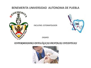 BENEMERITA UNIVERSIDAD AUTONOMA DE PUEBLA




              FACULTAD: ESTOMATOLOGÍA




                      ENSAYO:

 ENFERMEDADES PATOLÓGICAS DENTALES INFANTILES
 