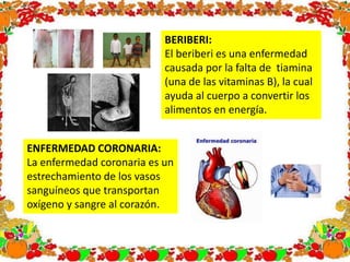 BERIBERI:
El beriberi es una enfermedad
causada por la falta de tiamina
(una de las vitaminas B), la cual
ayuda al cuerpo a convertir los
alimentos en energía.
ENFERMEDAD CORONARIA:
La enfermedad coronaria es un
estrechamiento de los vasos
sanguíneos que transportan
oxígeno y sangre al corazón.
 