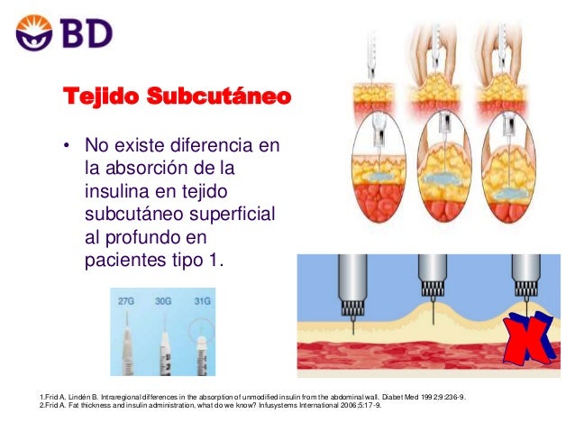 Presentacion diabetes ultima agujas cortas bd 2014 Armario Limpieza ~ Presentacion diabetes ultima agujas cortas bd 2014