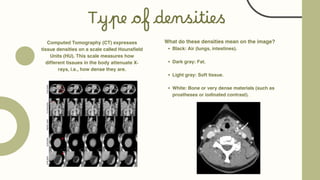 Type of densities
Computed Tomography (CT) expresses
tissue densities on a scale called Hounsfield
Units (HU). This scale measures how
different tissues in the body attenuate X-
rays, i.e., how dense they are.
What do these densities mean on the image?
Black: Air (lungs, intestines).
Dark gray: Fat.
Light gray: Soft tissue.
White: Bone or very dense materials (such as
prostheses or iodinated contrast).
 