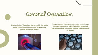 General Operation
X-ray emission: The patient lies on a table that slides
inside a ring (gantry). In this ring, an X-ray tube
rotates around the patient.
Image capture: As it rotates, the tube emits X-rays
that pass through the body. Detectors located on
the opposite side of the tube capture the attenuation
of the rays
 
