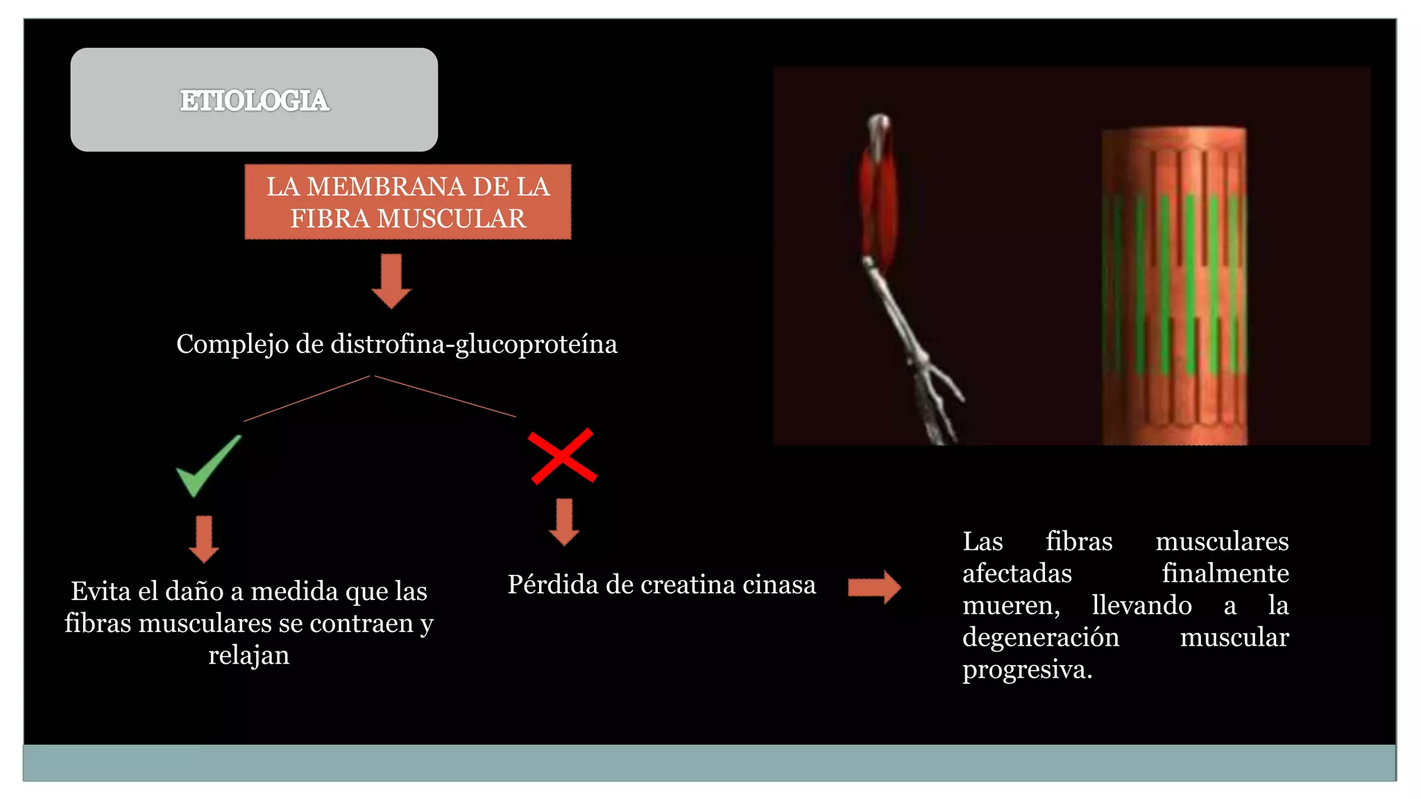 Presentacion distrofia muscular | PPTX