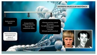 Presentacion distrofia muscular | PPTX