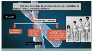 Presentacion distrofia muscular | PPTX